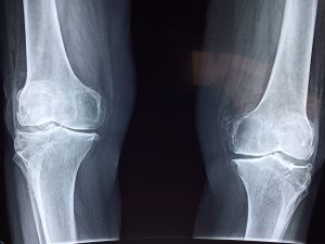 what is orthopedics